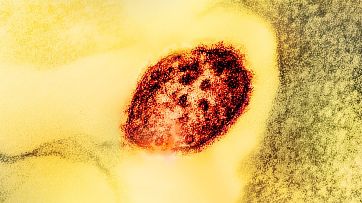 A colorized transmission electron micrograph showing a round measles virus particle in red against a dark background.