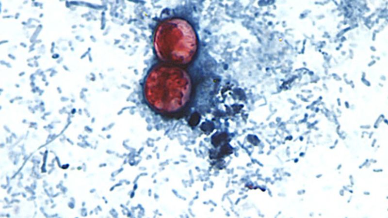 US Health Officials Are Investigating a Cyclospora Outbreak — a Diarrhea-Causing Parasite Tied to Lettuce